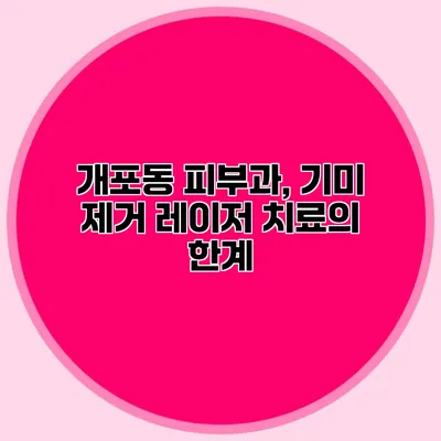 개포동 피부과, 기미 제거 레이저 치료의 한계